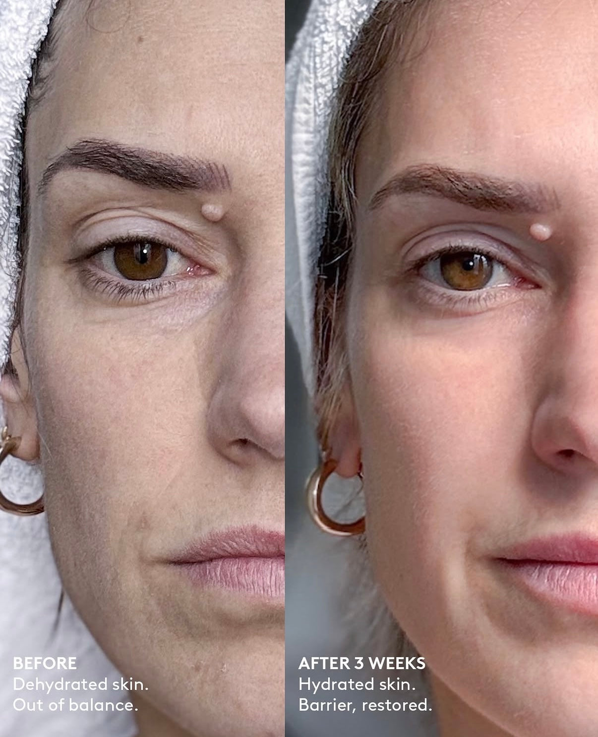 Hydrated skin versus dehydrated skin infographic