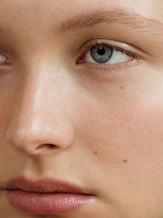 Naturally treating irritated and red skin with SuperYouSkin